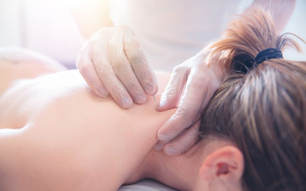 acupuntura