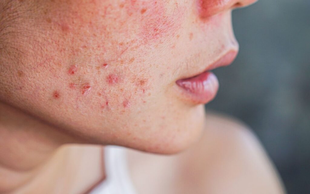 molesties inflamació